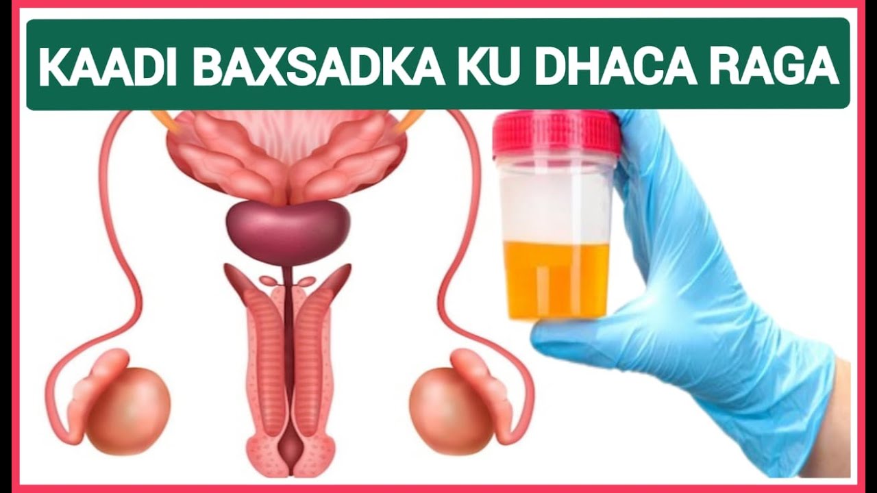 KAADI BAXSADKA KU DHACA RAGGA WAXA KENE NOCYADA U KALA BAXO DAWADA LO QAATO  #DrMahamedLibanMahamed