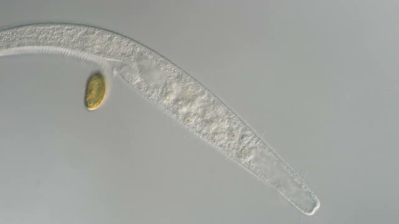 Ciliate Spirostomum 400x