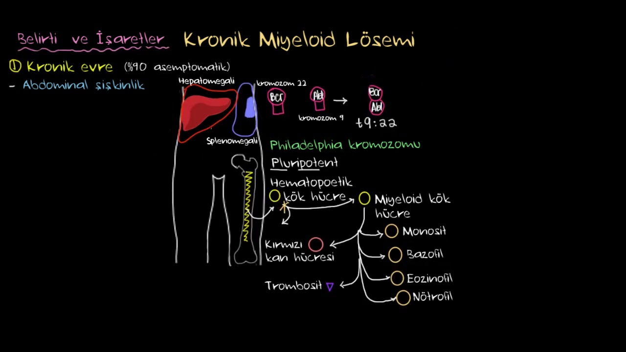 Kronik Miyeloid Lösemi (KML) Nedir? (Sağlık Bilgisi ve Tıp)