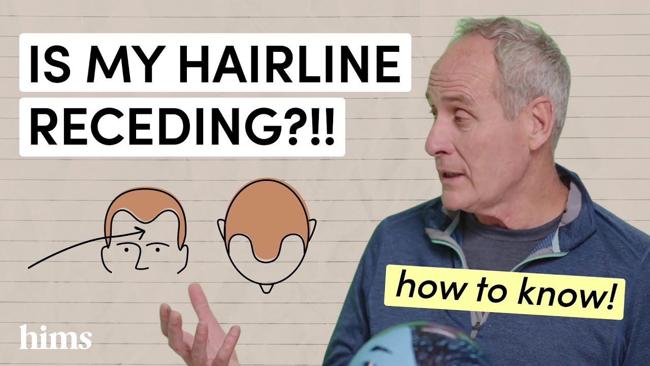 Decoding Hair Loss: Understanding the Norwood Scale