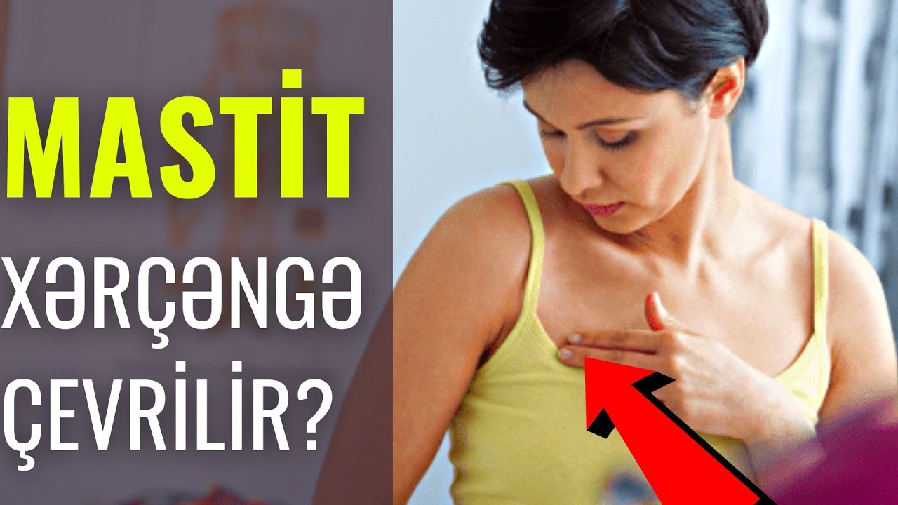 Döşünüzün Üstündə Belə Yara varsa DİQQƏT! - MASTİT SAĞALIR?