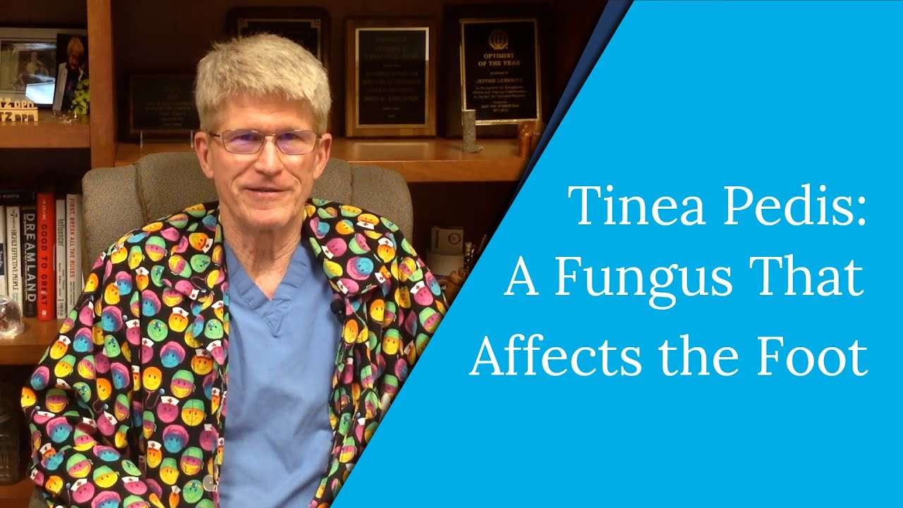 Tinea Pedis - The Fungus That Affects the Foot