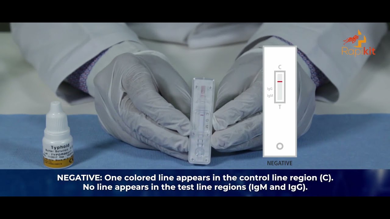 Rapikit Typhoid Rapid Test Instructional Video