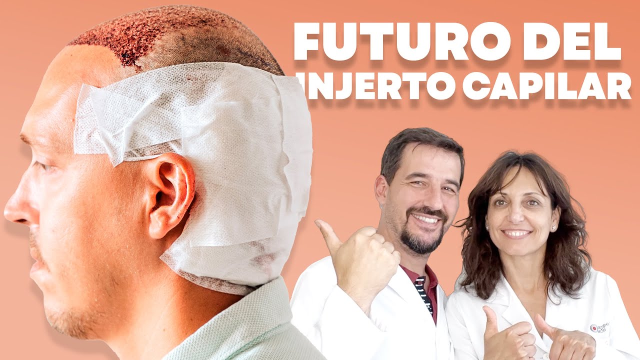 🔵 HACIA DONDE VAMOS: Trasplante Capilar. 🔬 CULTIVOS, células madre y más…