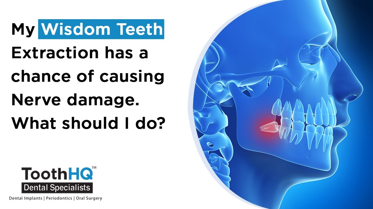 My Wisdom teeth extraction has a chance of causing Nerve damage. What should I do?