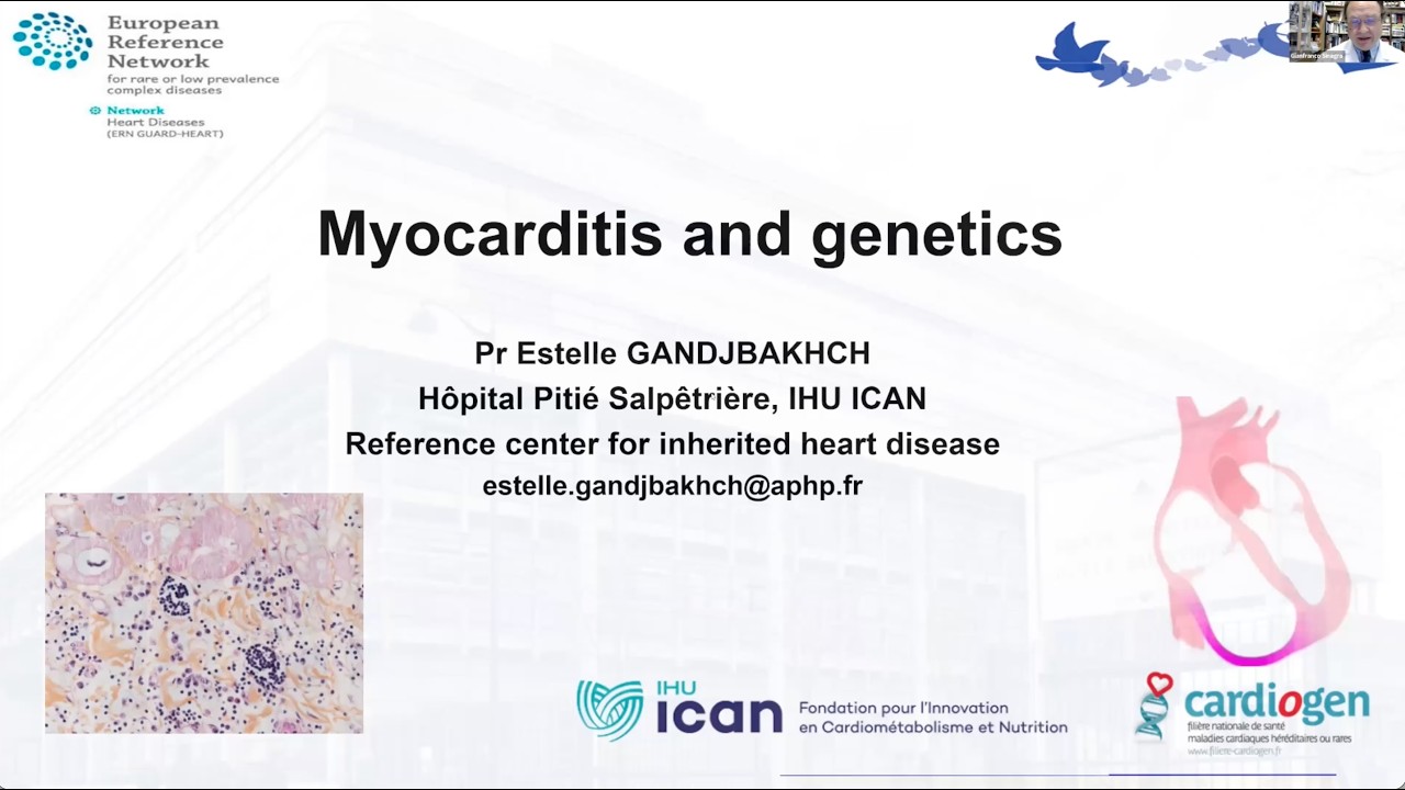 ERN GUARD-Heart webinar 34: Relationships between Myocarditis & Cardiomyopathies