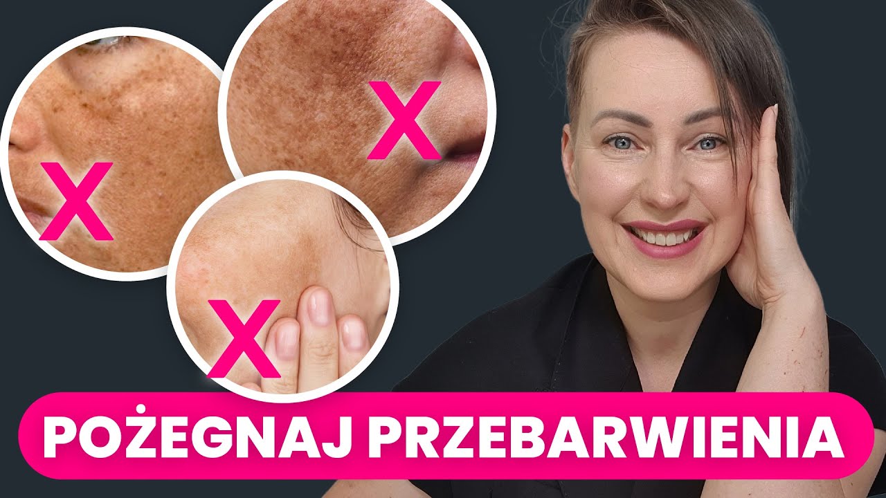 Jak SKUTECZNIE pozbyć się przebarwień? Nowe podejście 2025!