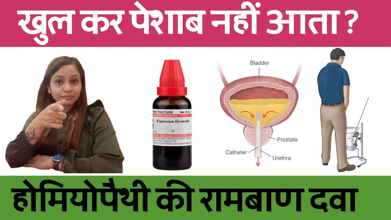 Low urine output | Low urine pressure male | Low urine flow treatment Homeopathic medicine