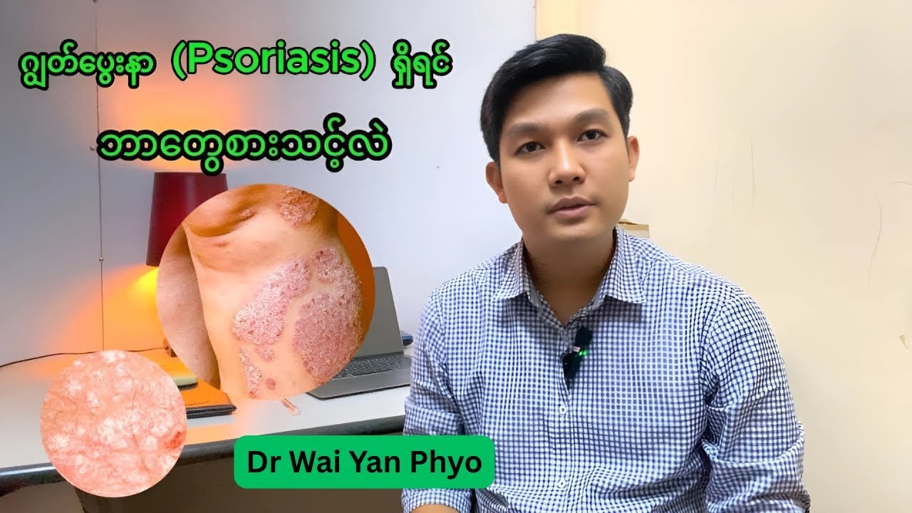 #ဂျွတ်ပွေးနာ #psoriasis  ရှိရင် ဘာတွေစားသင့်လဲ