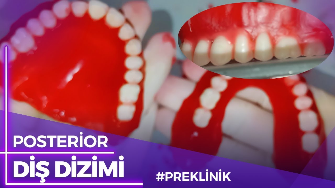 Posterior Diş Dizimi