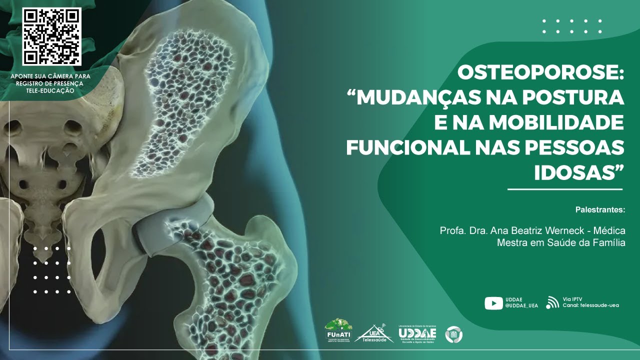 Osteoporose: “Mudanças na postura e na mobilidade funcional nas pessoas idosas”