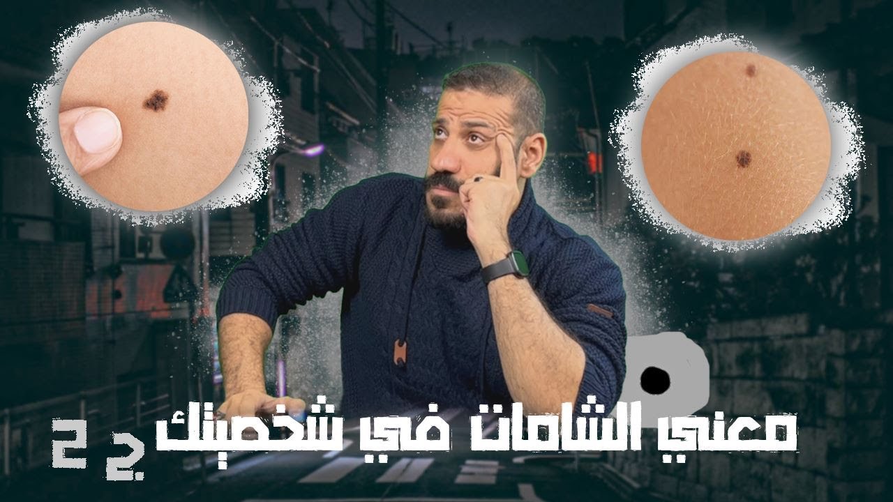معني الشامة علي الجسد أو الوجه