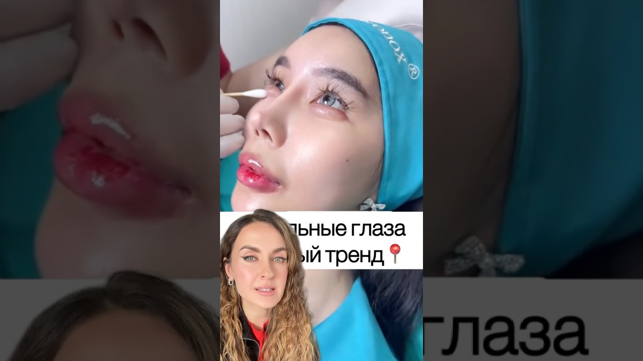 Кукольные глаза!Новый тренд молодости из Азии#ботокс #омоложение #подтяжка #массажлица #фейсбилдинг