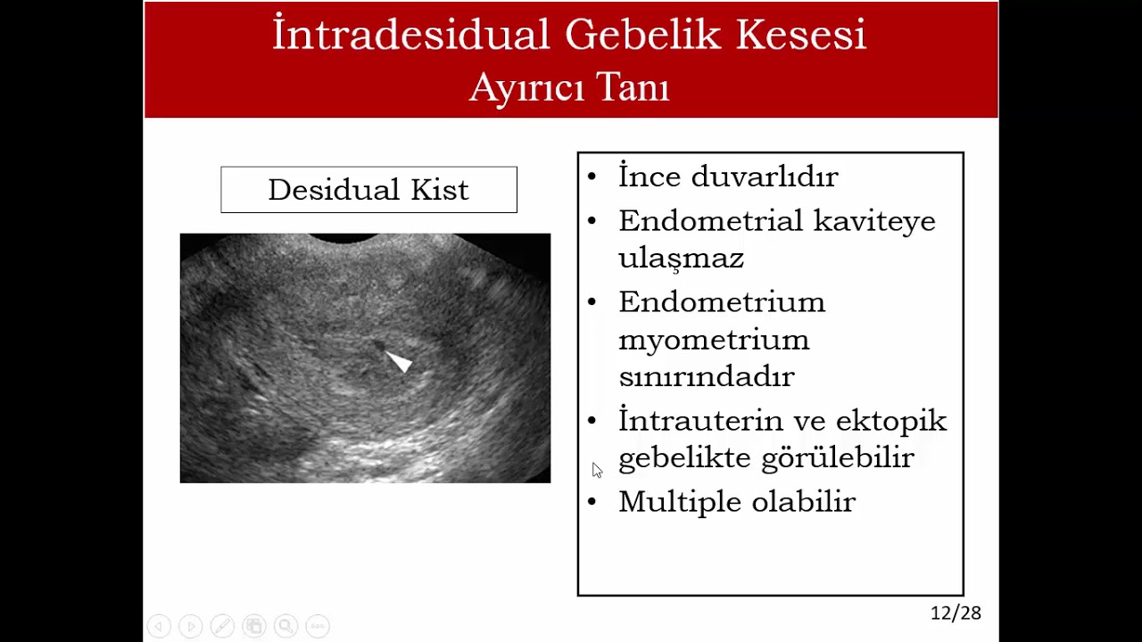 4 10 Hft USG Normal Bulgular
