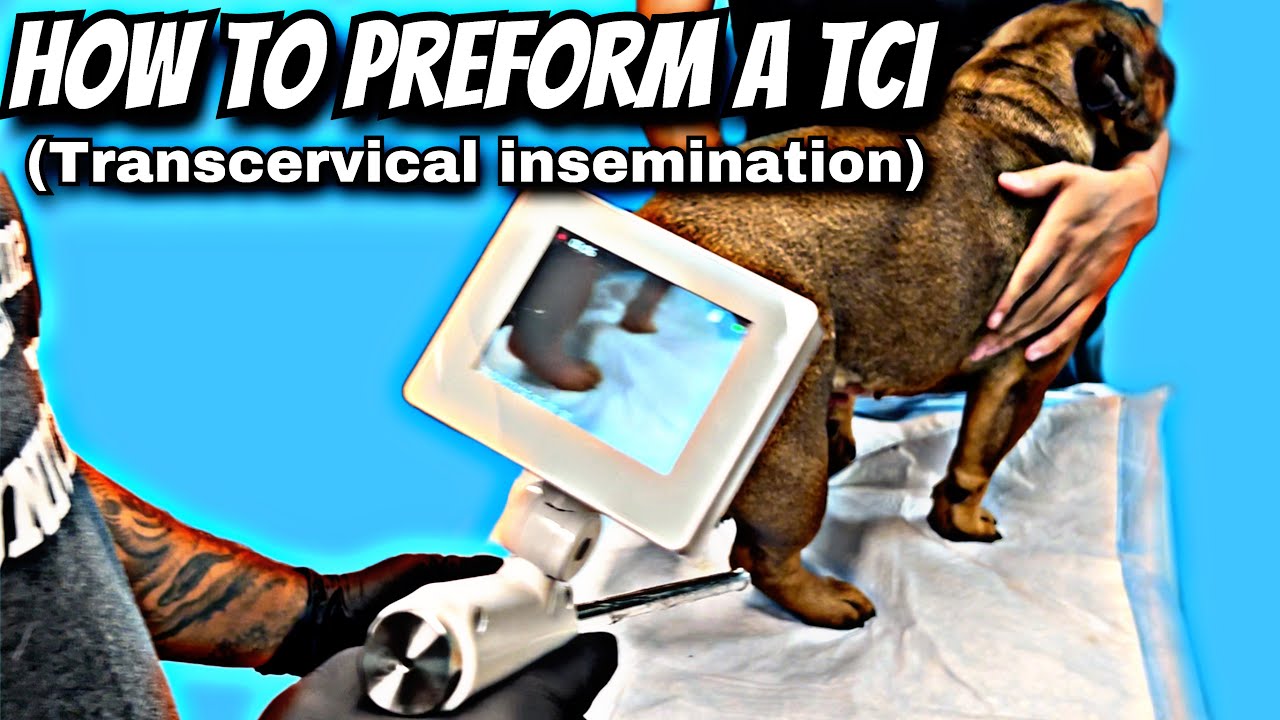 How to preform a Tci - (Transcervical insemination)