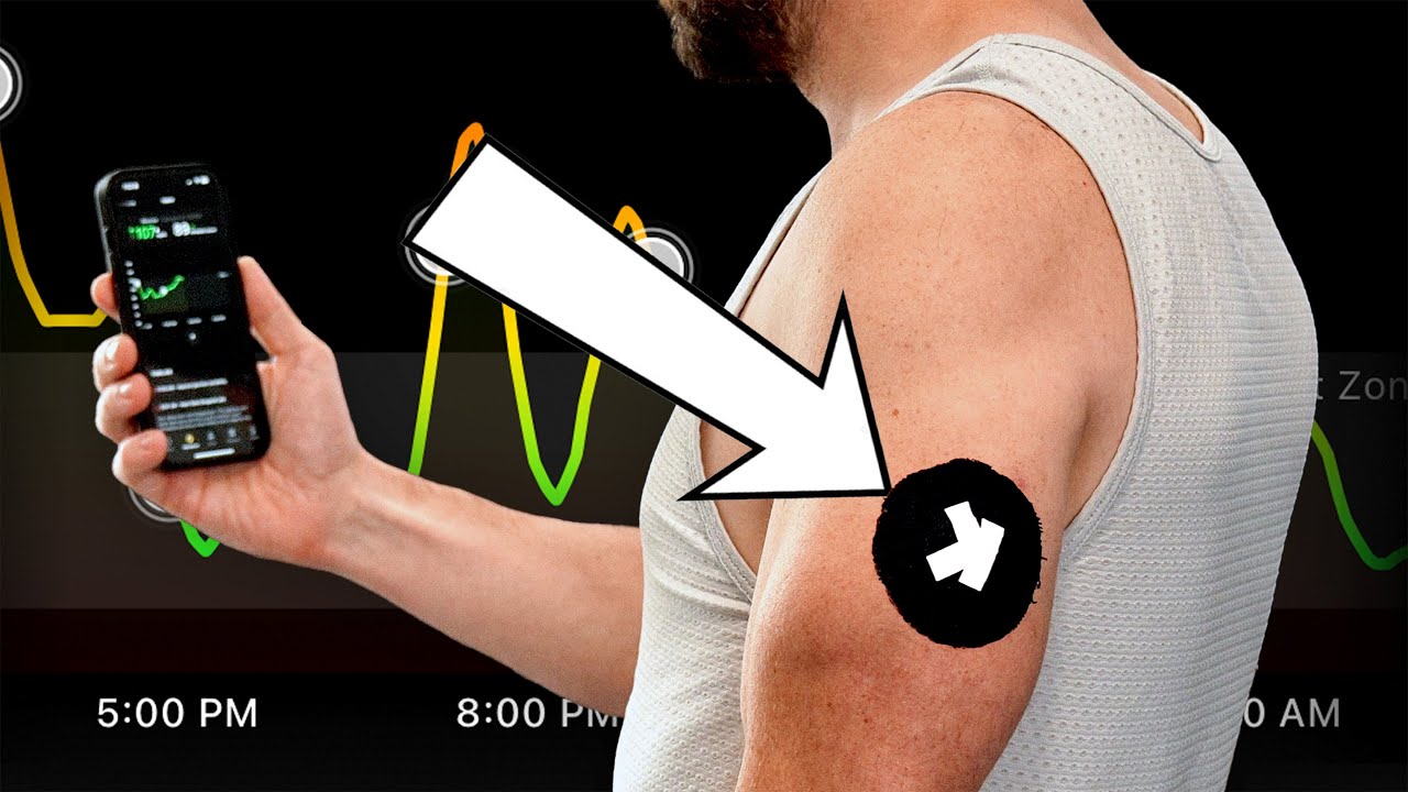 I INJECTED This Sensor to HACK My Metabolism - This is What I Learned (Ultrahuman M1 Live)