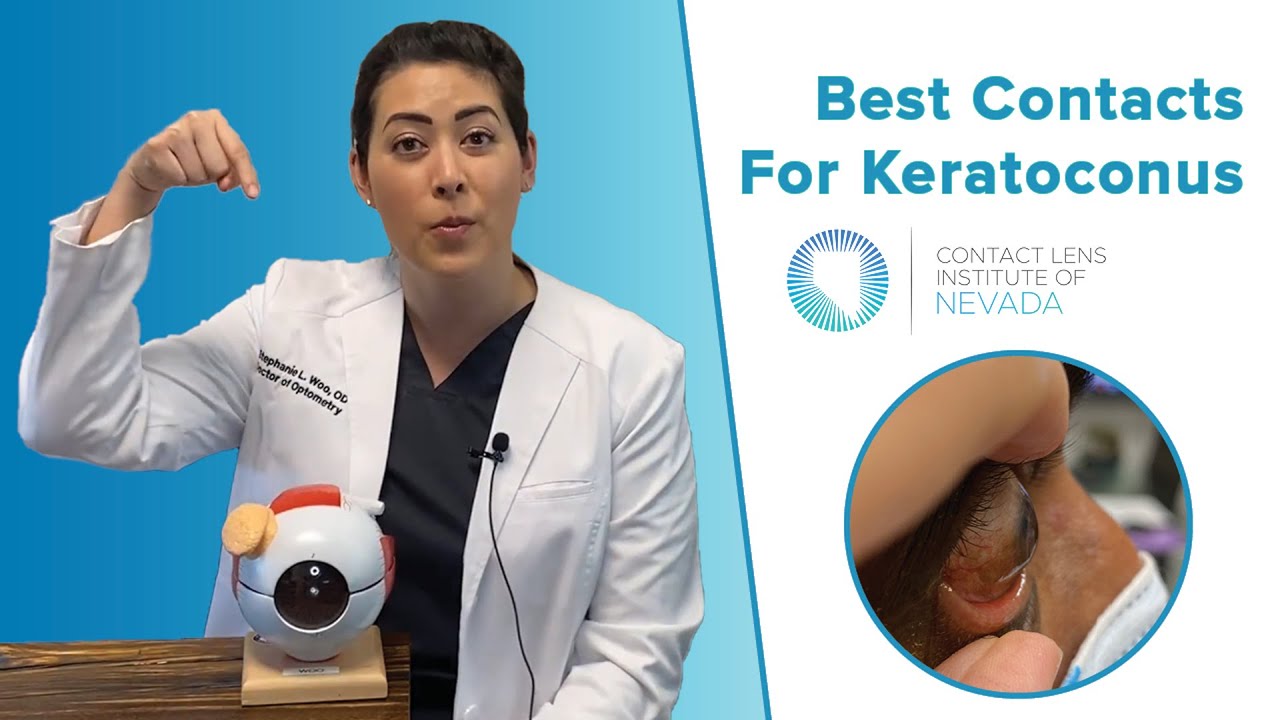 Best Contact Lenses For Keratoconus