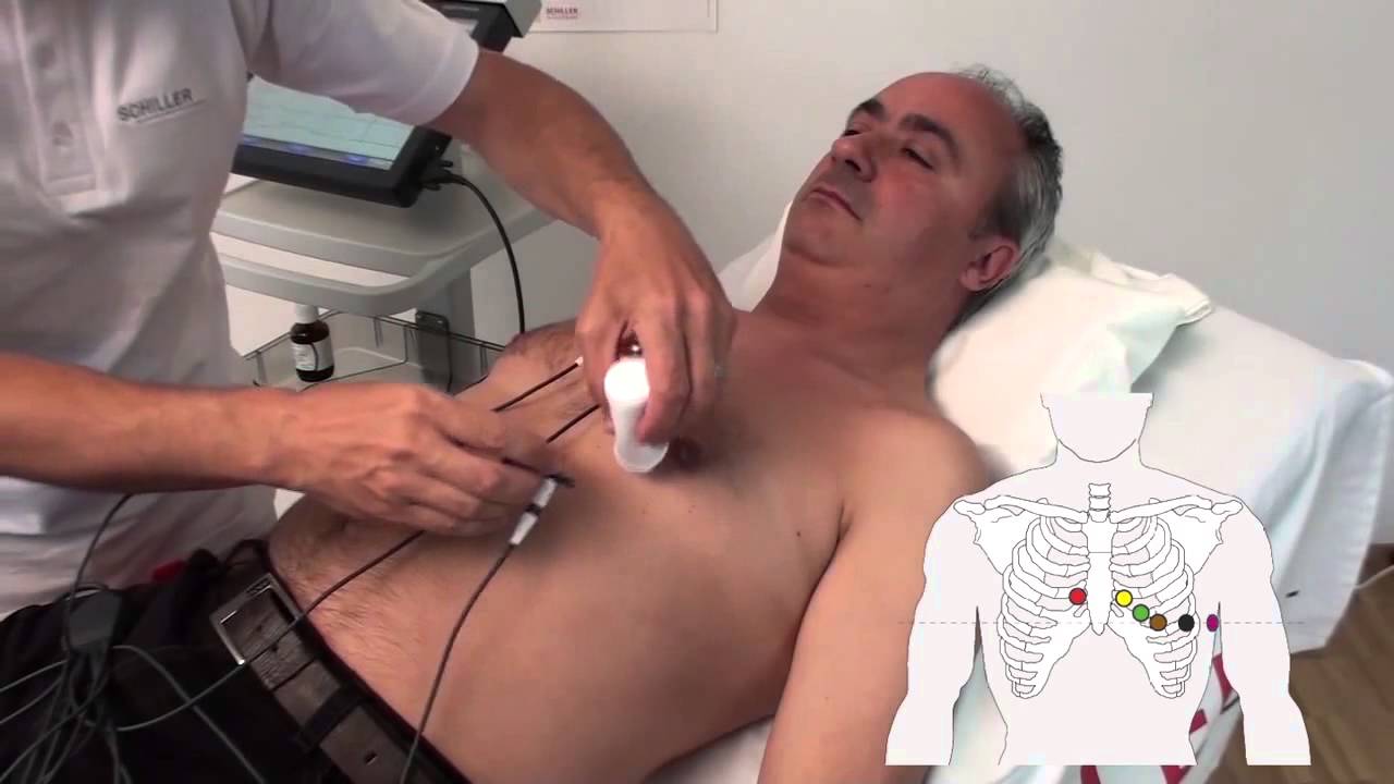 Методика регистрации ЭКГ покоя на базе электрокардиографа Cardiovit MS-2015