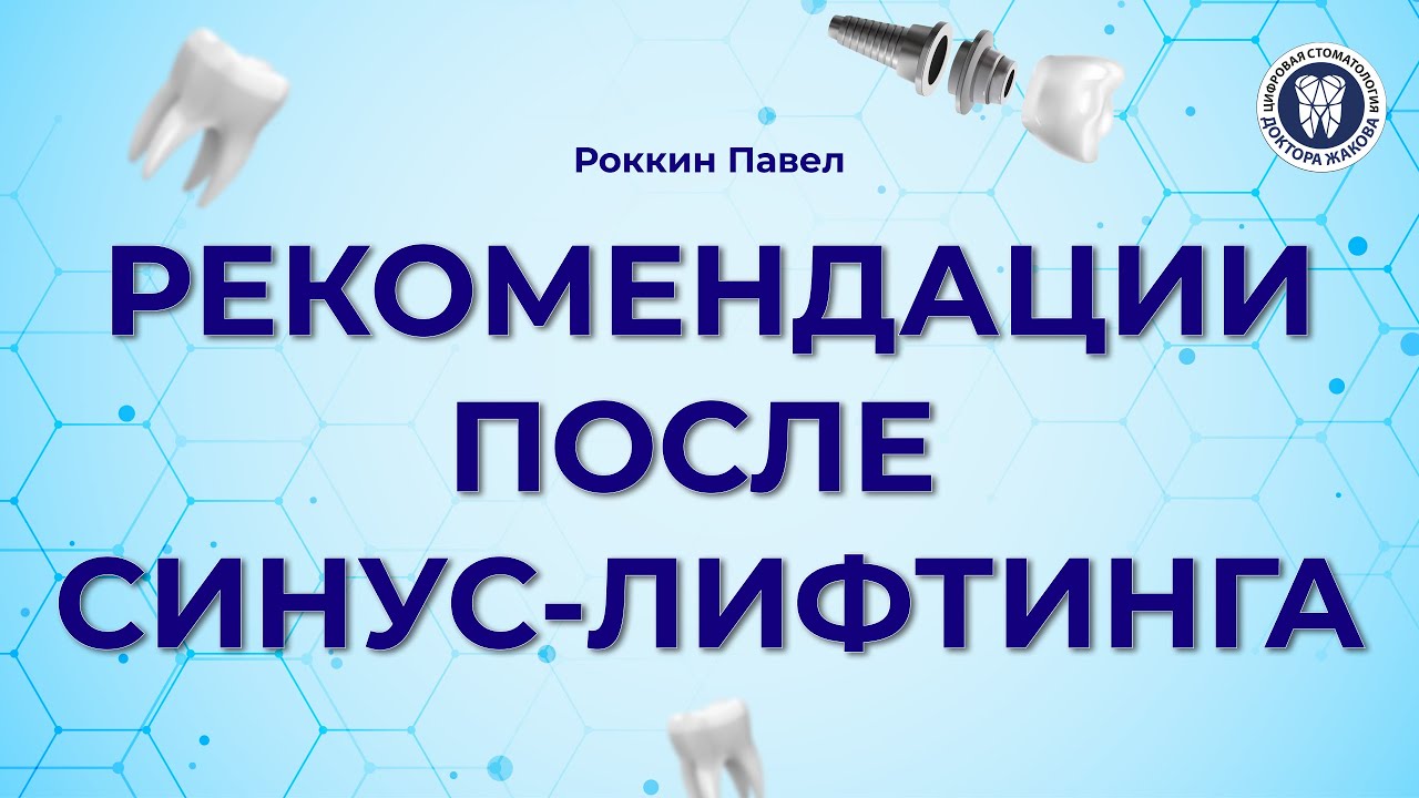 Рекомендации после синус-лифтинга