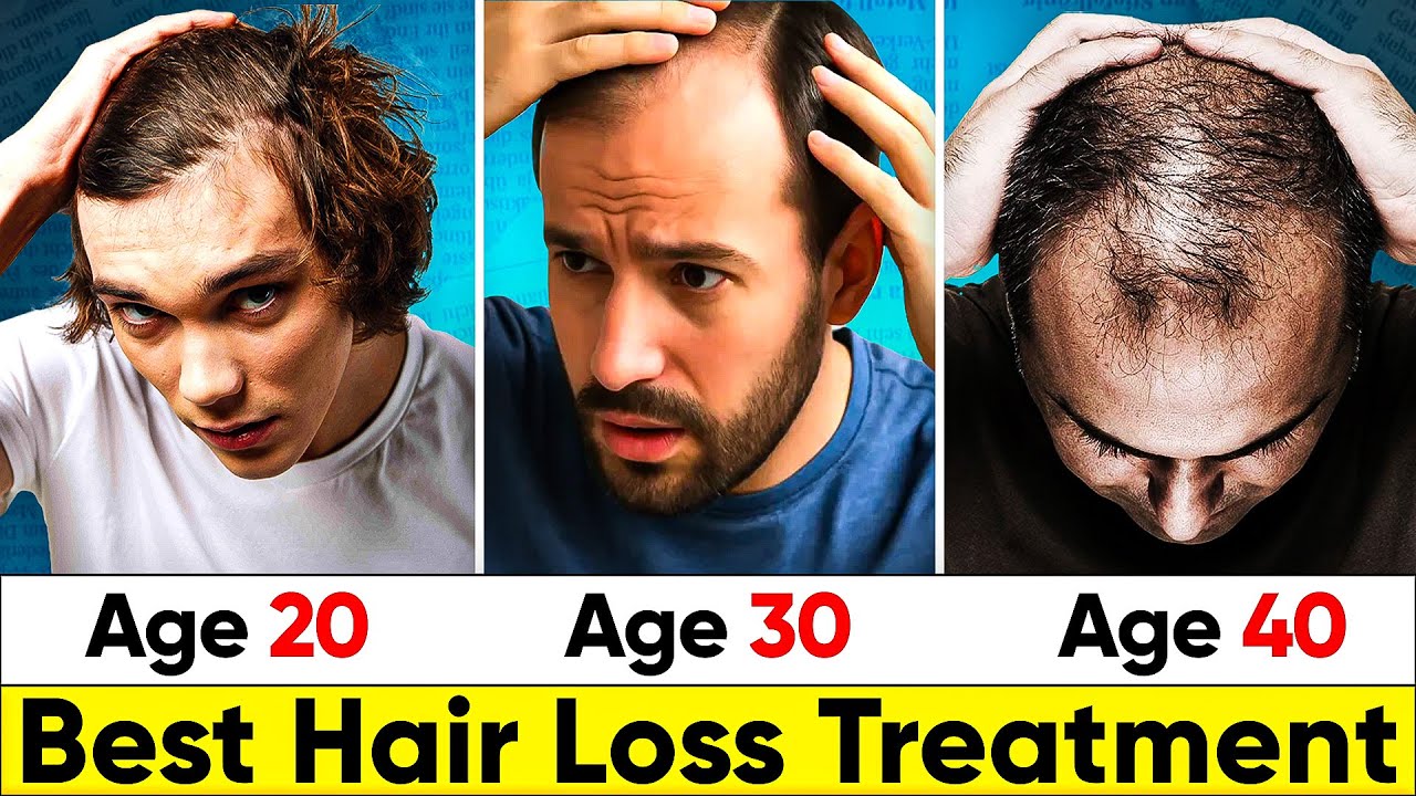 Hair Loss Treatment for Men in Their 20s, 30s, and 40s - Which Hair Loss Treatment is Best for You?