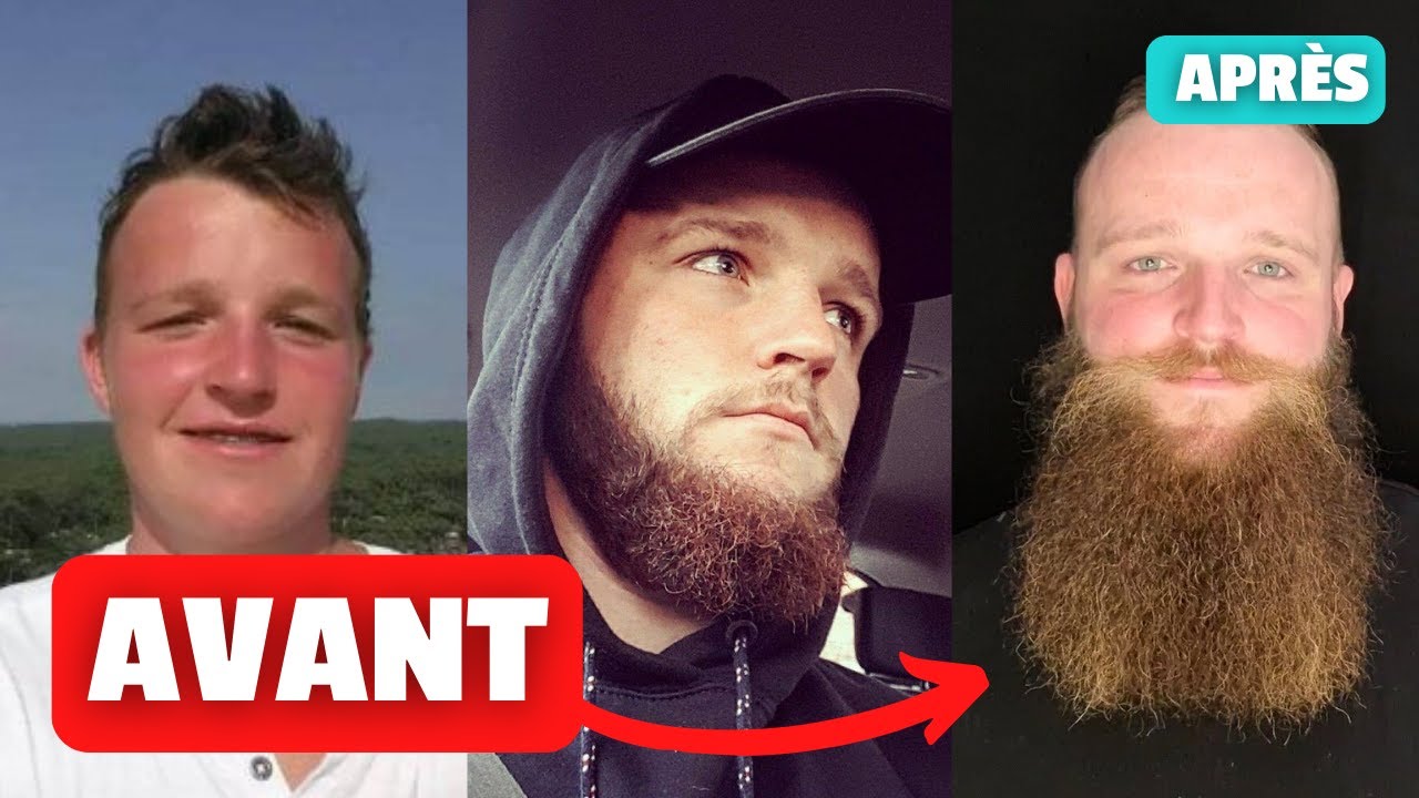 COMMENT AVOIR UNE BARBE RAPIDEMENT