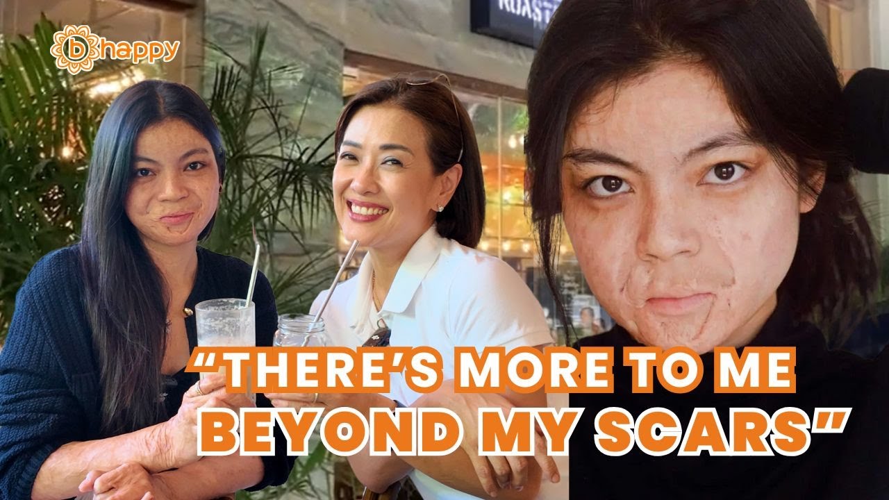 LARRA LASAM SURVIVED THE FIRE — NOW SHE’S REDEFINING BEAUTY | Bernadette Sembrano