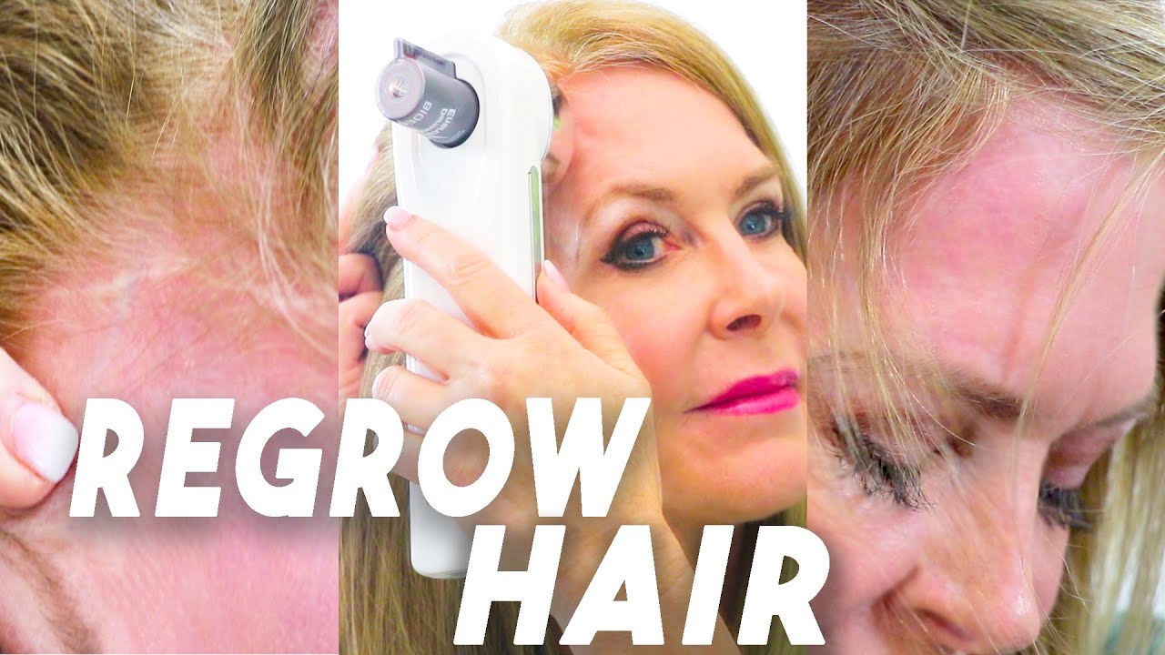 Thinning Hair Treatment | Reverse Thinning And Regrow‎ Bioequa
