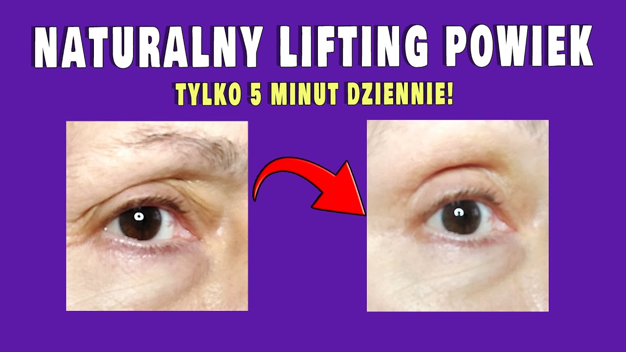 Opadające powieki? Oto najlepsze ćwiczenia na naturalny lifting powiek | Efekty bez operacji