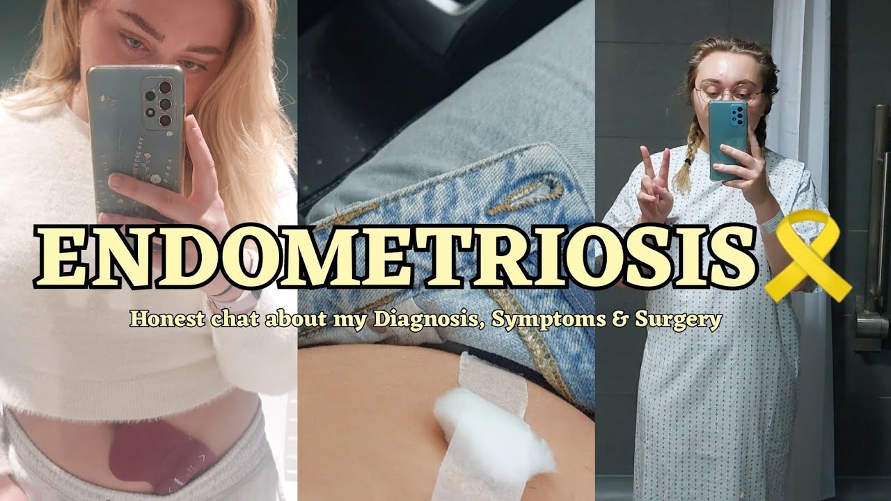 My Endometriosis Journey | Symptoms, Diagnosis & Laparoscopy Surgery