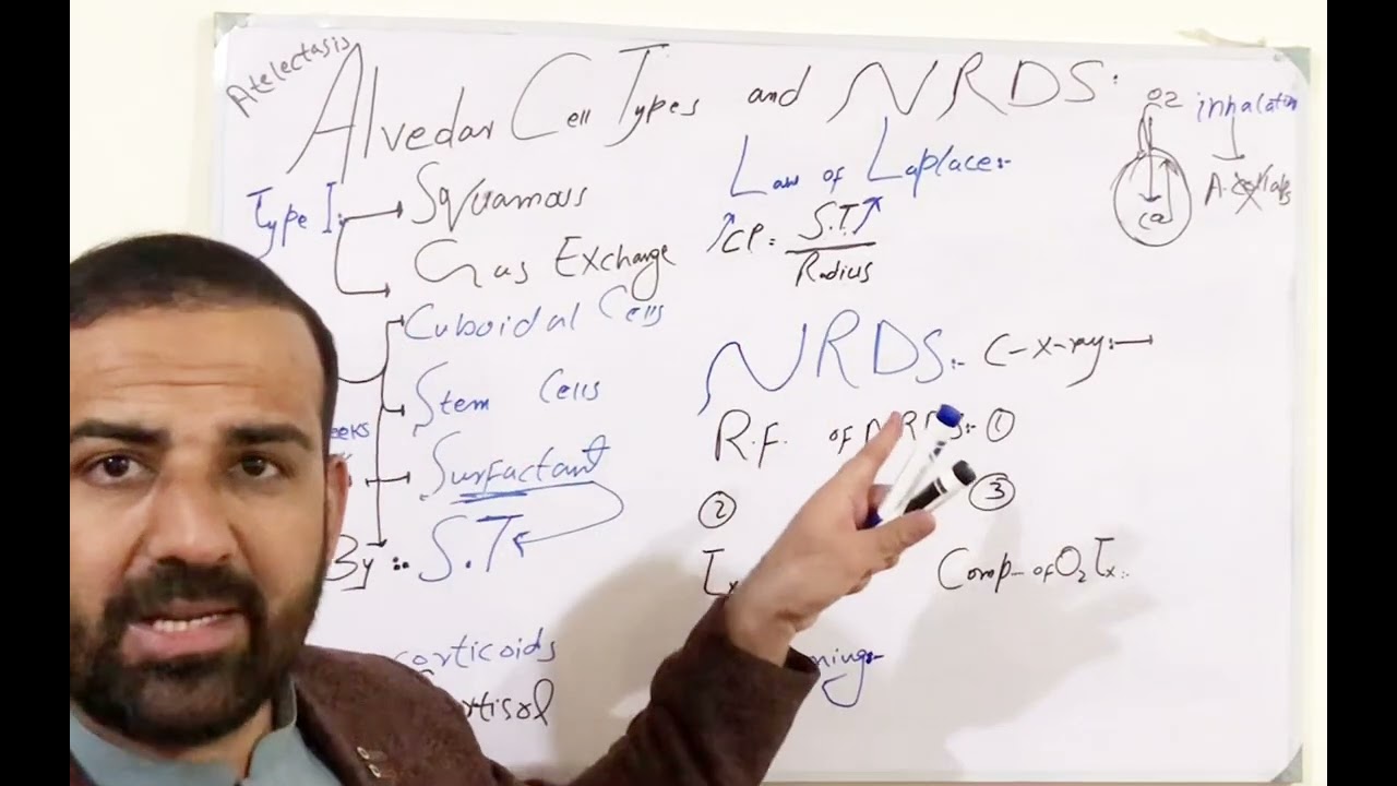 Alveolar cell types and NRDS