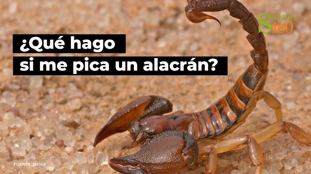 &iquest;Qu&eacute; hago si me pica un alacr&aacute;n? | Salud180