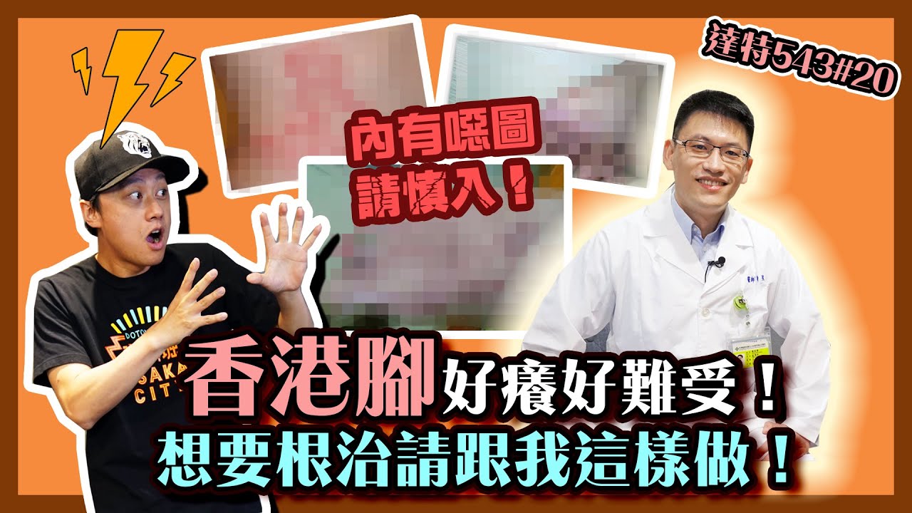 #香港腳