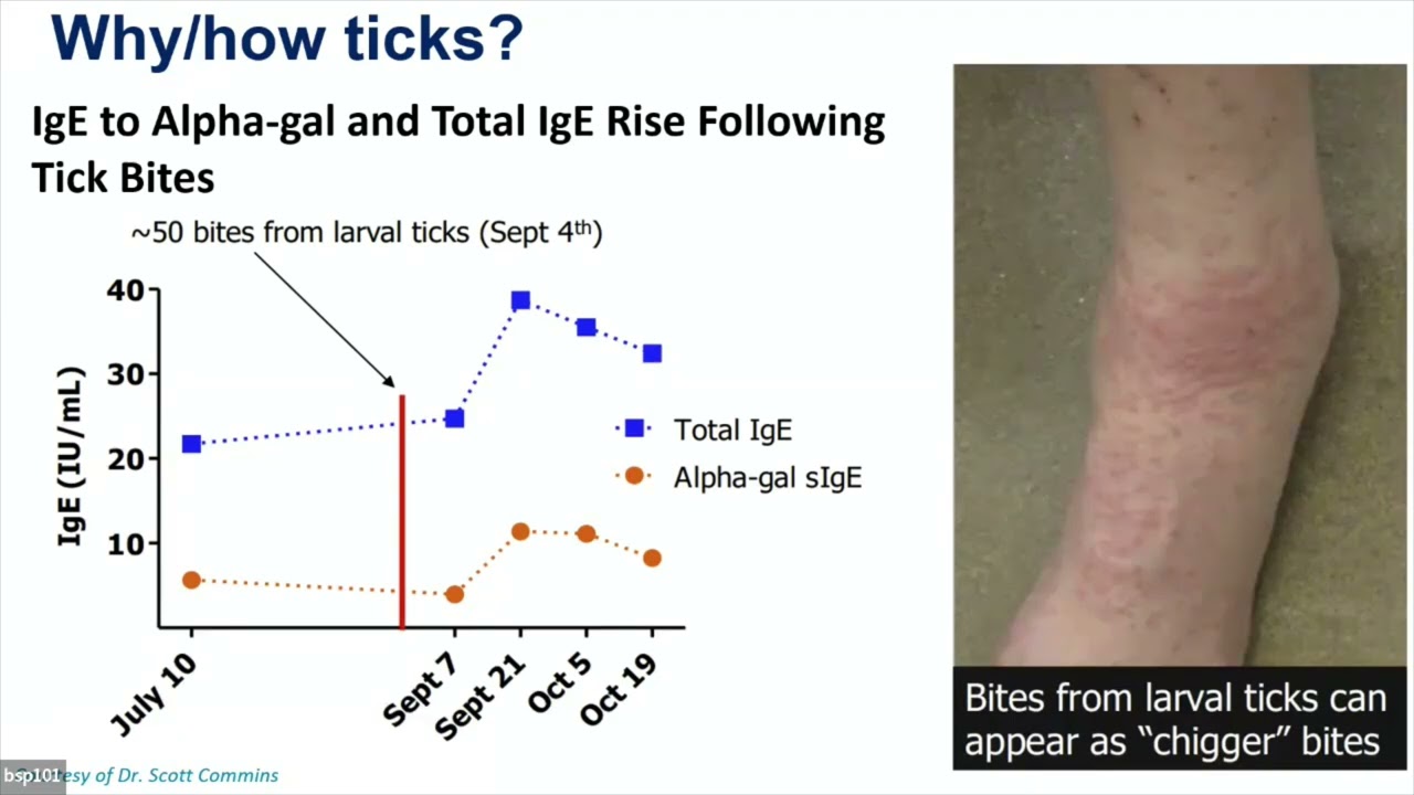 Tick Bite and Anaphylaxis: The Many Faces of Alpha Gal Allergy