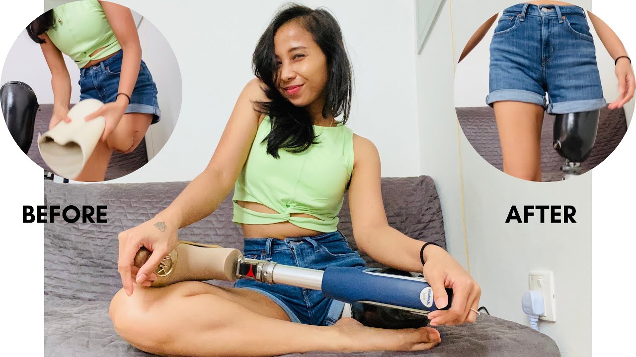 Amputee share &ldquo;how to wear prosthetic leg and give some tips!&rdquo;