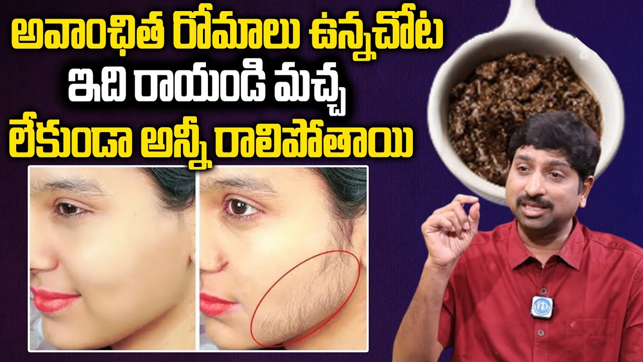 ఇది రాయండి చాలు అవాంఛిత రోమాలు మొత్తం రాలిపోతాయి.. | Remove Unwanted Hair | Facial Hair | iDream