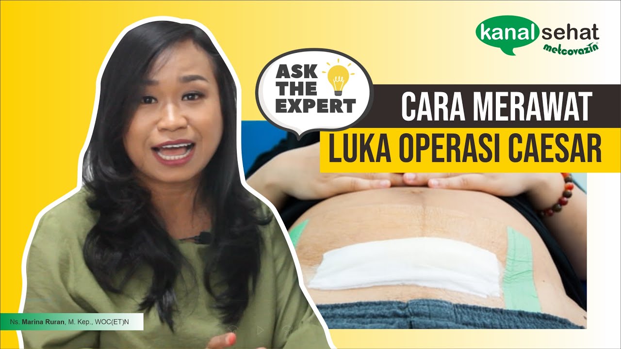 Cara merawat luka pasca operasi caesar (SC)! CEPAT SEMBUH TANPA INFEKSI