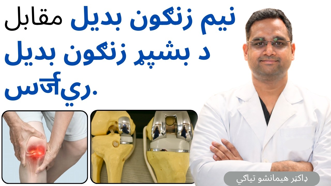 نیم زنګون بدیل مقابل د بشپړ زنګون بدیل سर्जري | Half Knee Vs Full Knee Replacement Surgery