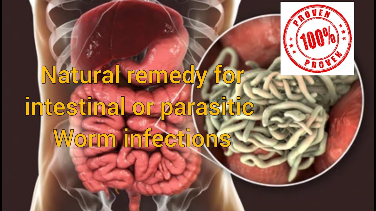 Natural remedy for Intestinal worms Or parasitic worms infections #wormsinfections #remedy