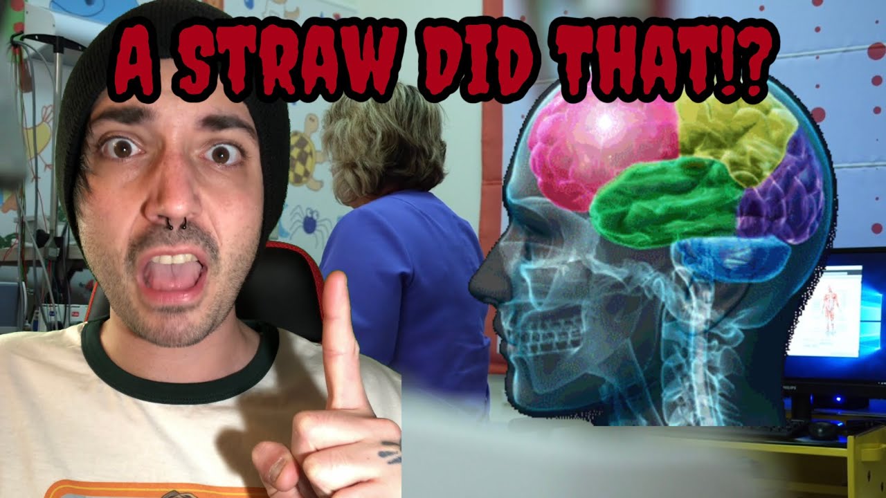 3 Freak Accidents YOU WON&rsquo;T BELIEVE 😨 #facts #shocking