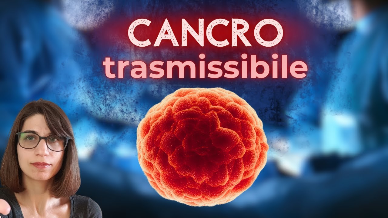 IL CANCRO &egrave; CONTAGIOSO? Opera un paziente e prende il suo cancro