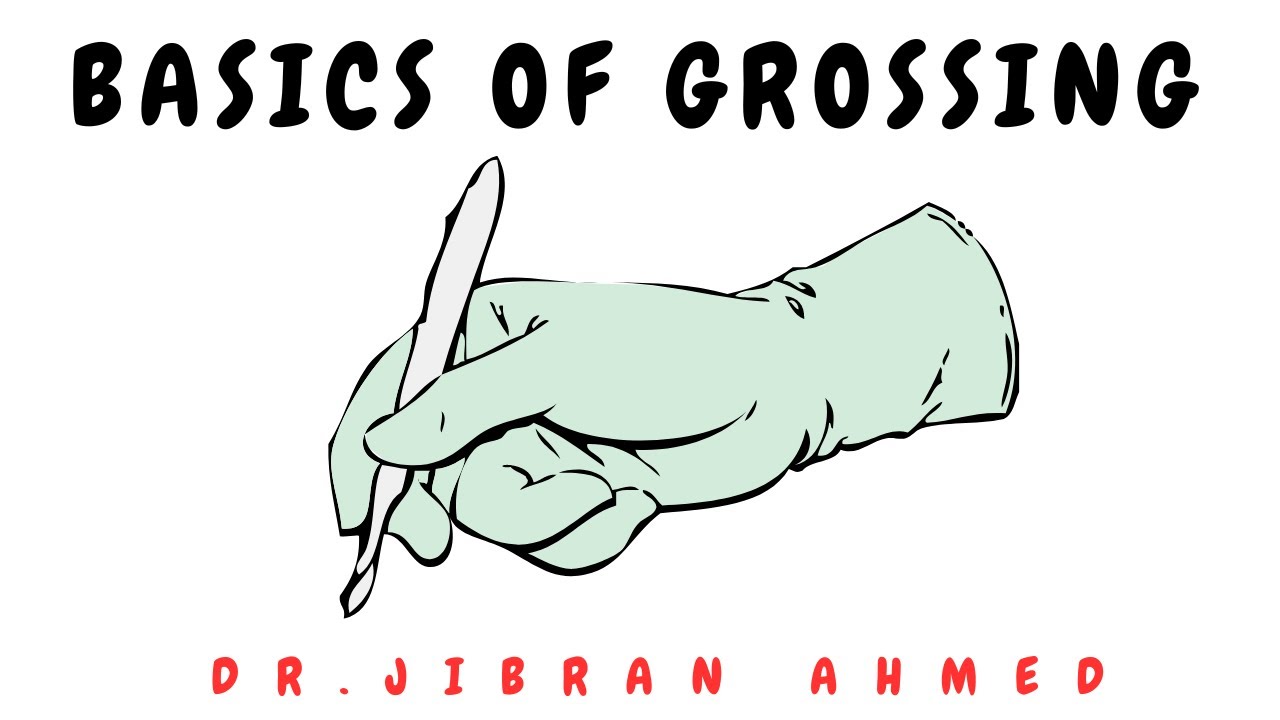 BASICS OF GROSSING