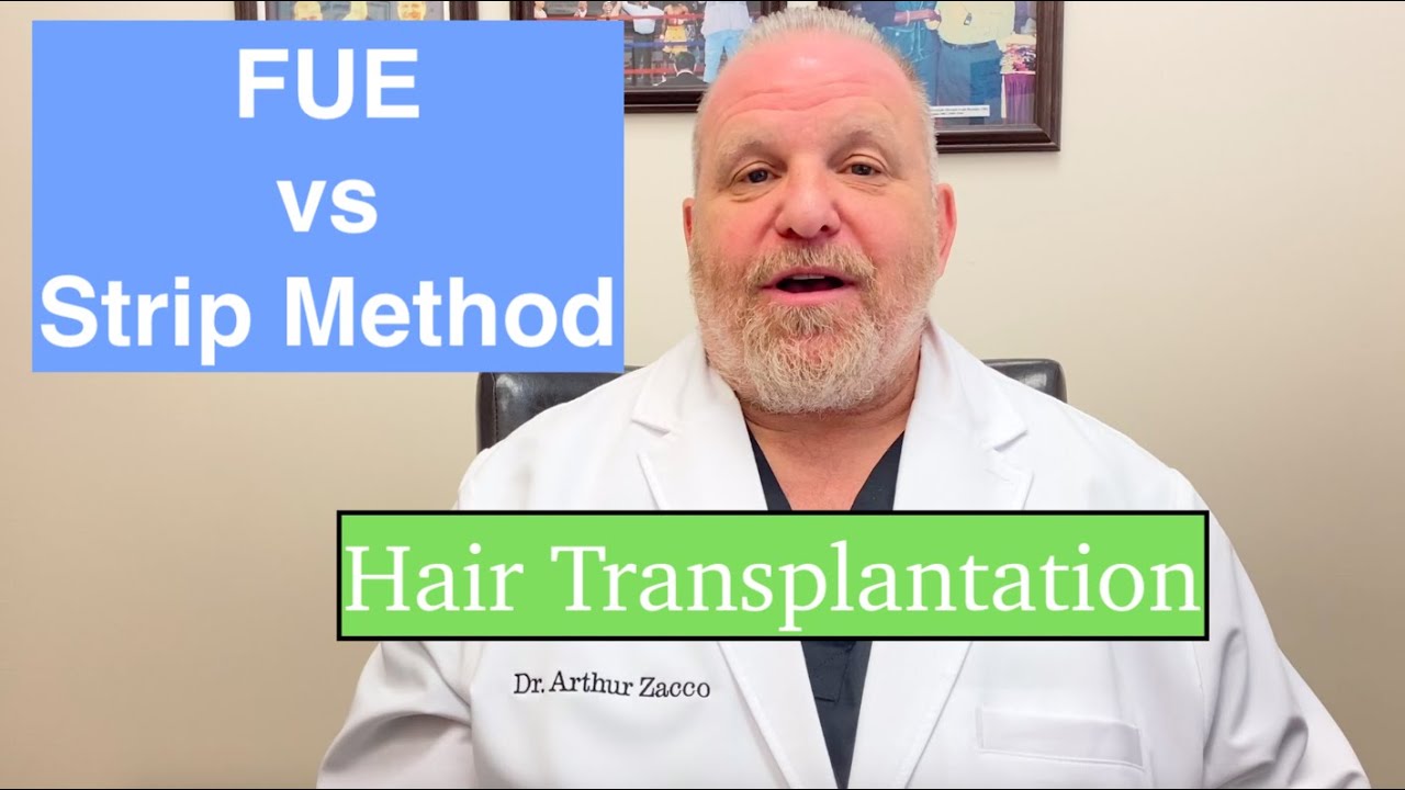 Hair Transplantation Techniques - Compare FUE vs Strip Method