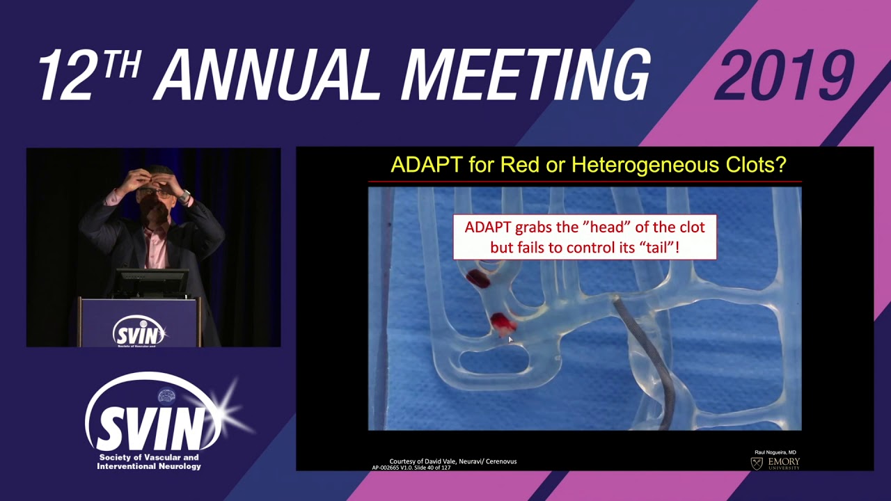 SVIN 2019: Defining & Achieving Clinical Success: An Evolution of Thrombectomy