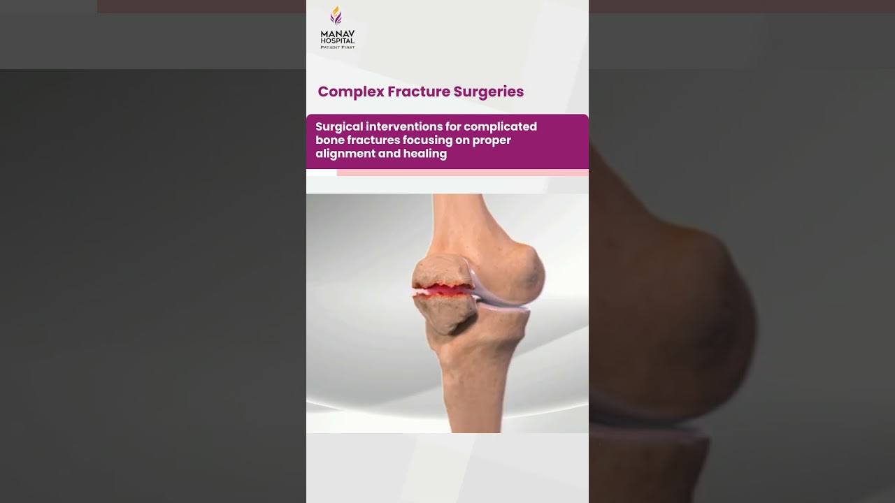 Orthopaedic Services at Manav Hospital | Dr. Sharad Gupta |