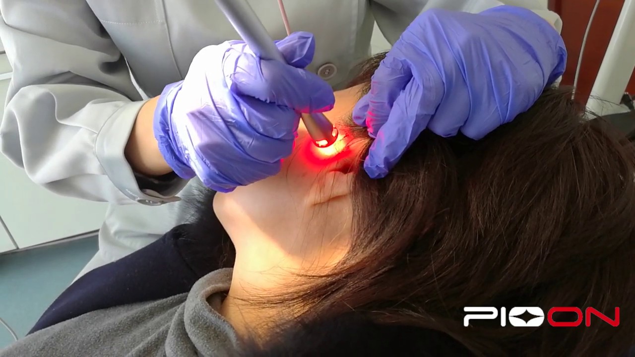 TMJ Treatment (temporomandibular joint)