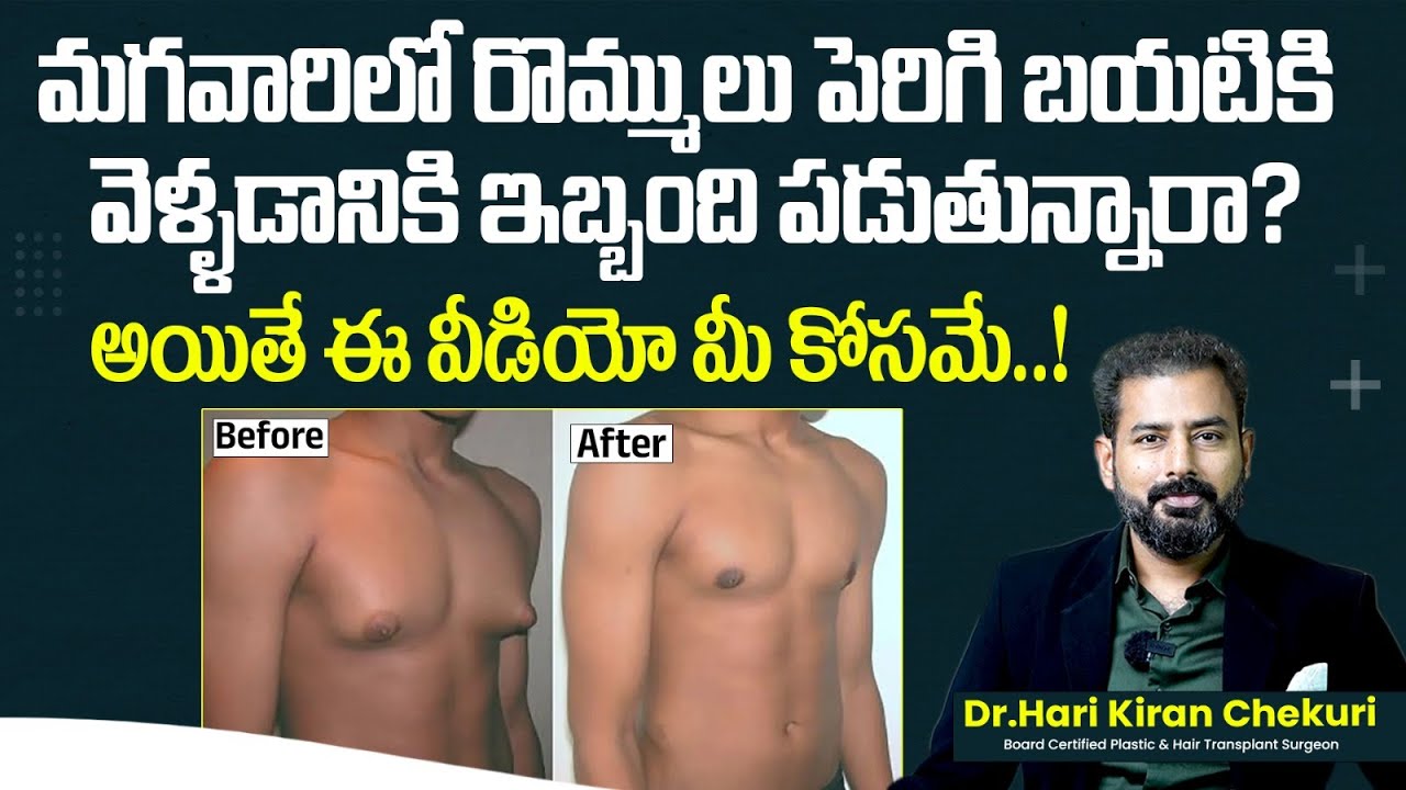 Gynecomastia Causes || Gynecomastia Symptoms and Treatment in Telugu || ReDefine Channel