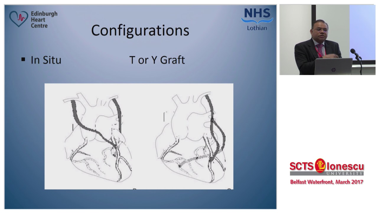 Barriers to the Use of Bilateral Internal Mammary Arteries