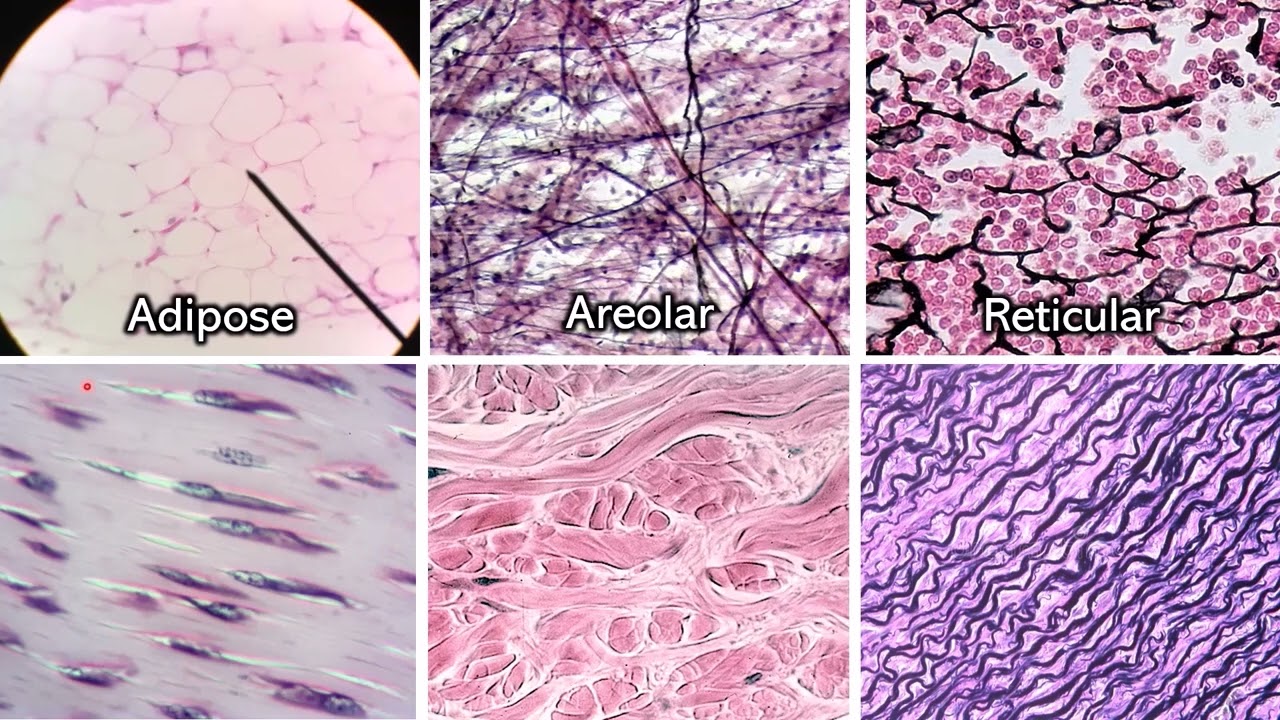 Identifying Connective Tissue | Review and Practice