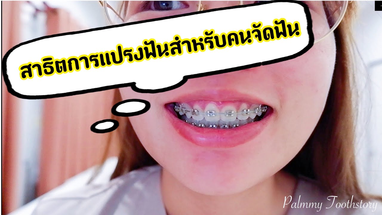 สาธิตการแปรงฟันสำหรับคนจัดฟัน (อย่างละเอียด)
