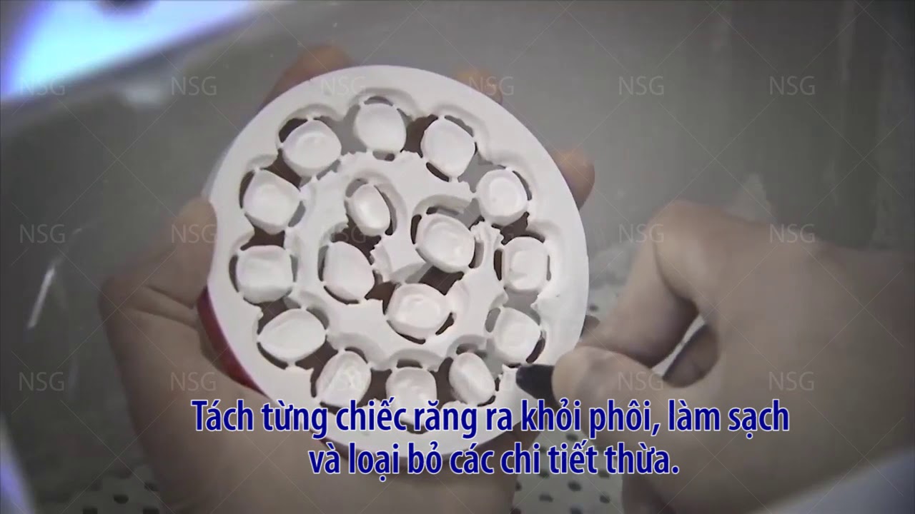 Quá trình chế tác răng sứ tại Labo
